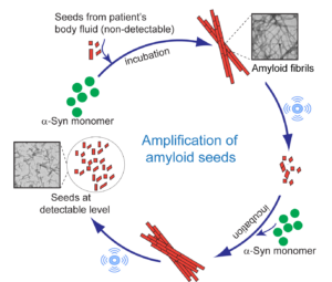 Blood Test for Parkinson’s