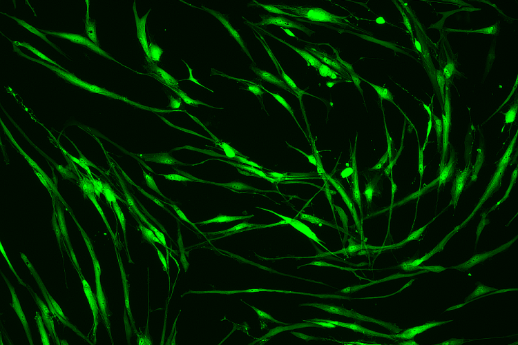 21D cells in TC flask